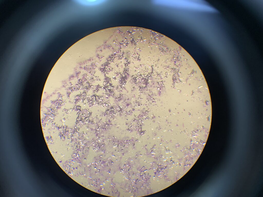 Microscopic view of feline urine sample showing crystal formations related to urinary blockage.